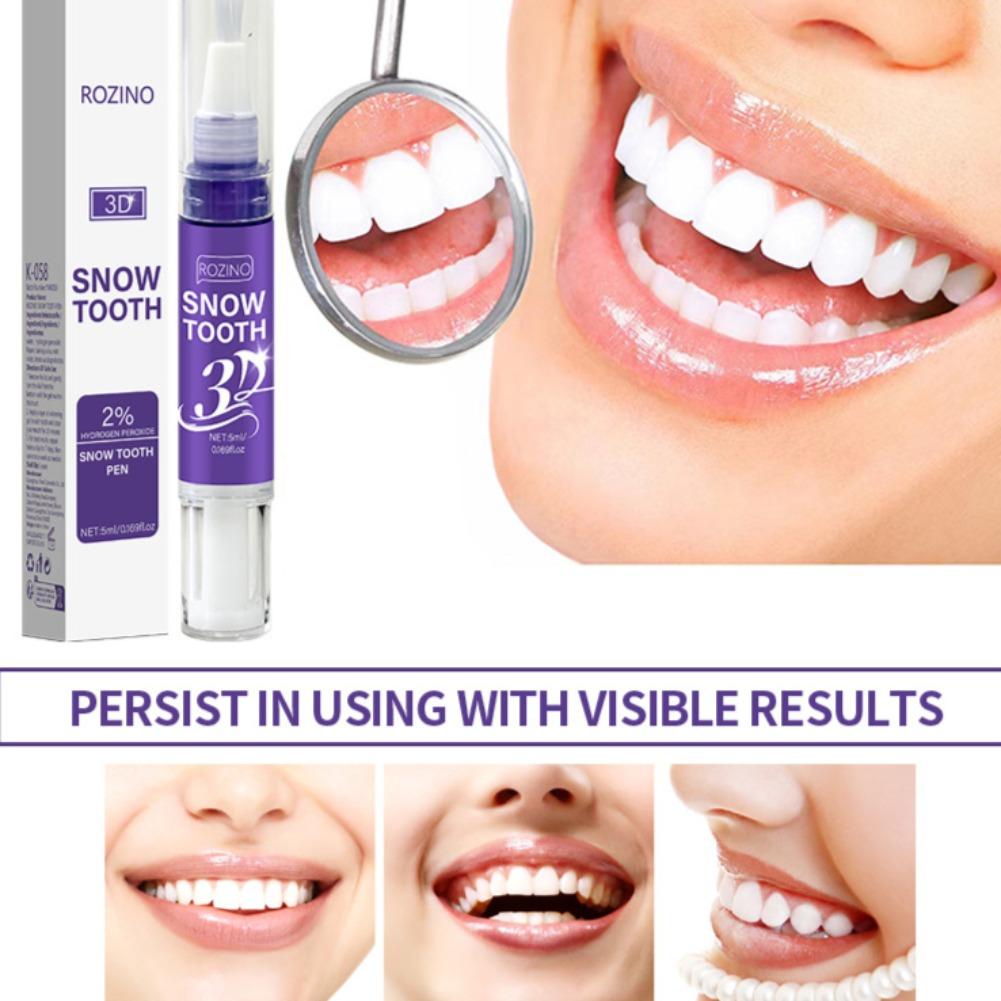 Stylo blanchissant pour dents  - Teeth Whitening Near Me avis et prix