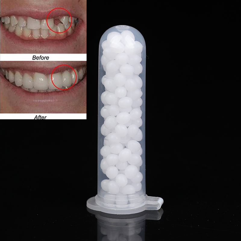 【K】1 boîte de kit de réparatio - Teeth Whitening Kit avis et prix