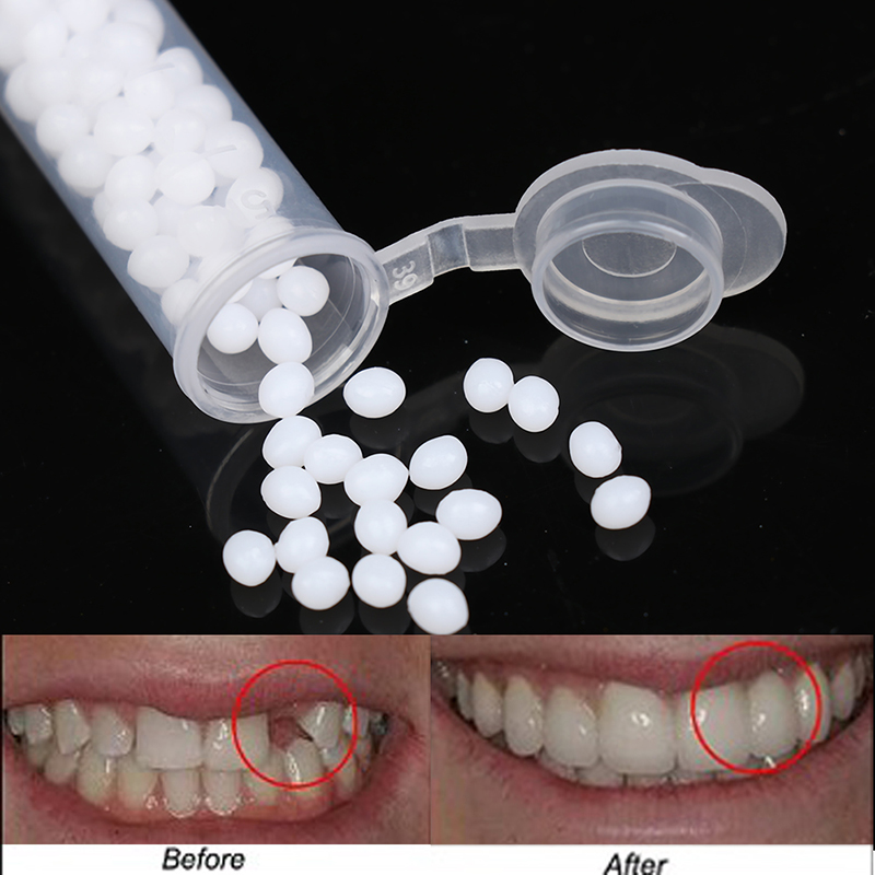 【K】1 boîte de kit de réparatio - Teeth Whitening Kit avis et prix